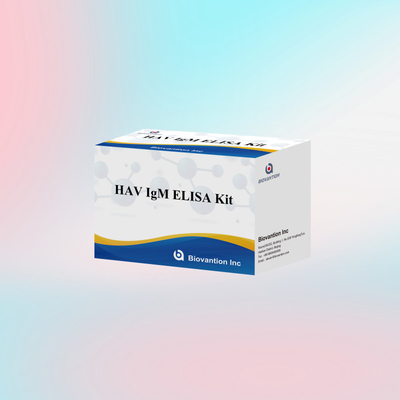 HAV IgM ELISA Test Kit Reagent การวินิจฉัยในมนุษย์