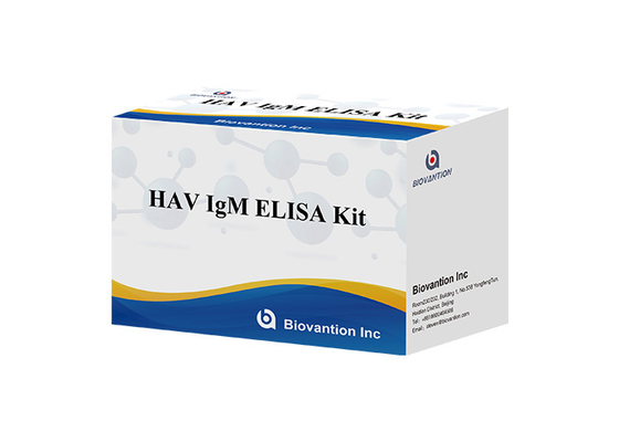 แอนติบอดีต่อไวรัสโรคตับอักเสบ A HAV IgM In Vitro Enzyme Immunoassay เซรั่ม / พลาสมา