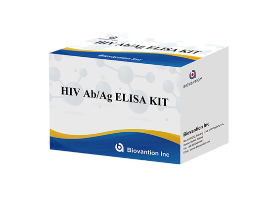 อานติบอดี / แอนติเจน ELISA Test Kit ของไวรัสภูมิคุ้มกันของมนุษย์