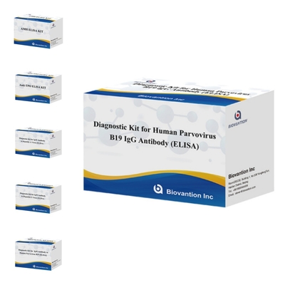 คิทวินิจฉัยสําหรับแอนติบอดี IgM parvovirus B19 ของมนุษย์ ELISA เหมาะสําหรับโรคระบาดของโรคระบาดของโรคระบาดของโรคระบาดของโรคระบาดของโรคระบาดของโรคระบาดของโรคระบาดของโรคระบาดของโรคระบาดของโรคระบาดของโรค