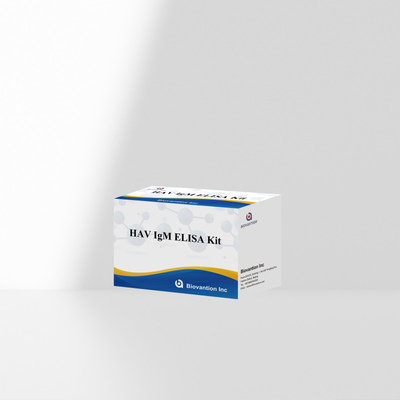 HAV IgM ELISA Kit ความรู้สึกสูง โรคตับอักเสบ A การตรวจพบไวรัส การตรวจสอบการวินิจฉัยที่แม่นยําที่น่าเชื่อถือสําหรับห้องปฏิบัติการคลินิก