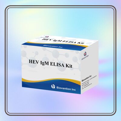 ชุดทดสอบ HEV IgM Elisa ความรู้สึกสูง ขนาด 96T และเวลาทดสอบ 2-3 ชั่วโมงสําหรับการวินิจฉัยที่แม่นยํา
