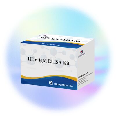 ชุดทดสอบ HEV IgM Elisa ความรู้สึกสูง ขนาด 96T และเวลาทดสอบ 2-3 ชั่วโมงสําหรับการวินิจฉัยที่แม่นยํา