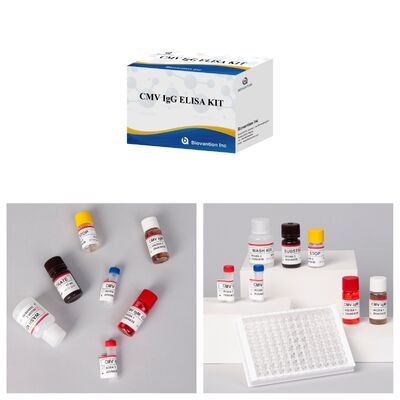 96T CMV ELISA Test Kit กับการตรวจจับด้วยสีและวิธีแซนวิชสําหรับแอนติบอดีต่อไวรัสไซโตเมกัลโวรัส