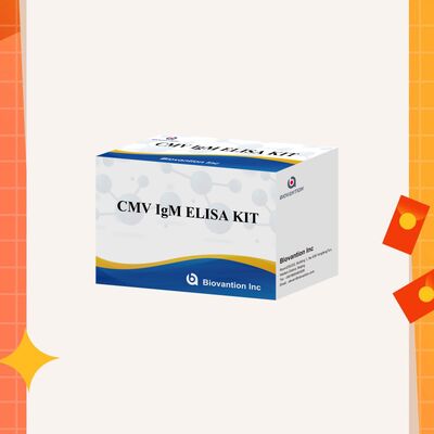 96T CMV ELISA Test Kit กับการตรวจจับด้วยสีและวิธีแซนวิชสําหรับแอนติบอดีต่อไวรัสไซโตเมกัลโวรัส