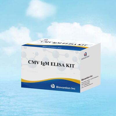 96T CMV ELISA Test Kit กับการตรวจจับด้วยสีและวิธีแซนวิชสําหรับแอนติบอดีต่อไวรัสไซโตเมกัลโวรัส