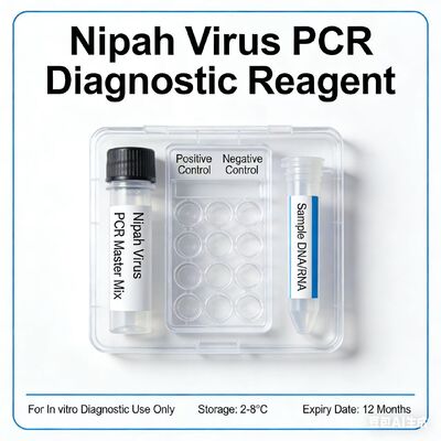 High Sensitivity Real-Time RT-PCR Kit for Nipah Virus RNA Detection with Internal Control