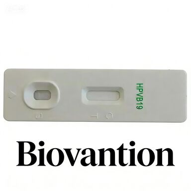 One Step Colloidal Gold Rapid Test For IgM Antibody To Human Parvovirus B19