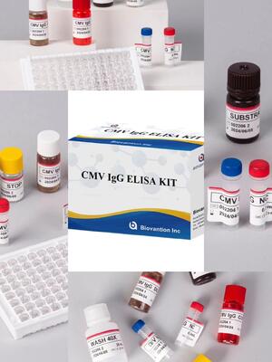 ห้องปฏิบัติการหรือโรงพยาบาล CMV IgG Elisa Test Kit ความแม่นยําสูง