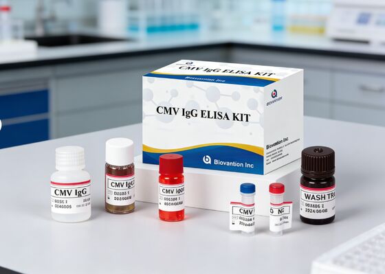 ห้องปฏิบัติการหรือโรงพยาบาล CMV IgG Elisa Test Kit ความแม่นยําสูง