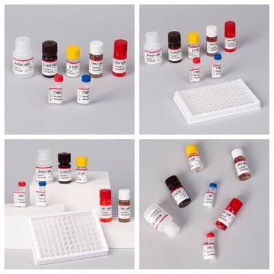 Enzyme Immunoassay Reagents Elisa Test Kit สําหรับการตรวจพบแอนติบอดี CMV ของไวรัสไซโตเมกาโลไวรัส