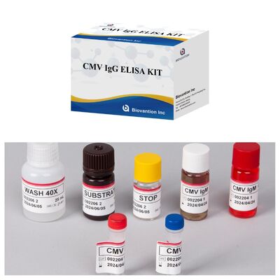 96T CMV ELISA Test Kit กับการตรวจจับด้วยสีและวิธีแซนวิชสําหรับแอนติบอดีต่อไวรัสไซโตเมกัลโวรัส