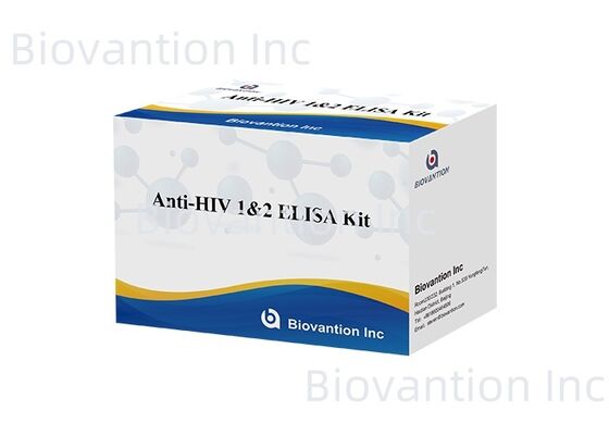 HIV 1/2 ELISA Test Kit 96T การตรวจพบแอนติบอดีไวรัสภูมิคุ้มกันของมนุษย์