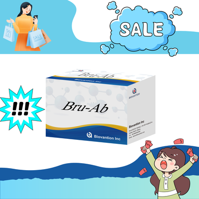 ชุด ELISA แอนติบอดีต่อบรูเซลล่าของมนุษย์ IgG/IgM ชุดทดสอบ ELISA การวินิจฉัยเซรั่มบรูเซลโลซิส เพื่อตรวจพบตัวอย่างของมนุษย์
